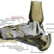Illustration for article titled Pott’s Fracture or: Tim, Oh My God, I’m So Sorry About Your Leg
